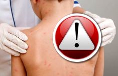 Októberben 64 új kanyarós esetet jelentettek 