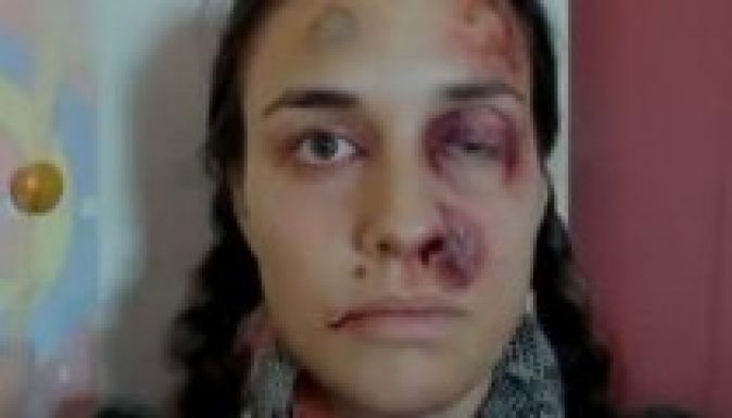 Dokumentálta életének egy évét az erőszakos férj felesége  (VIDEÓ)