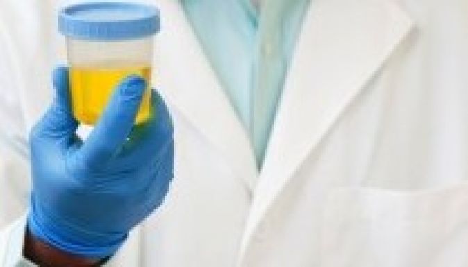 Méhnyakrák: vizeletvizsgálat válthatná a kenetvételt a szűréseken