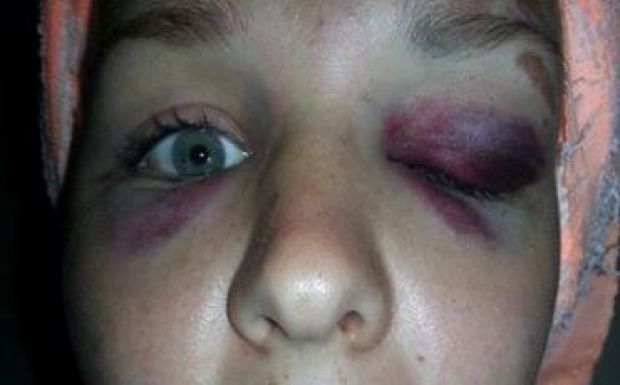 Megvertek egy lányt Szegeden, mert bevándorlónak nézték a barátját