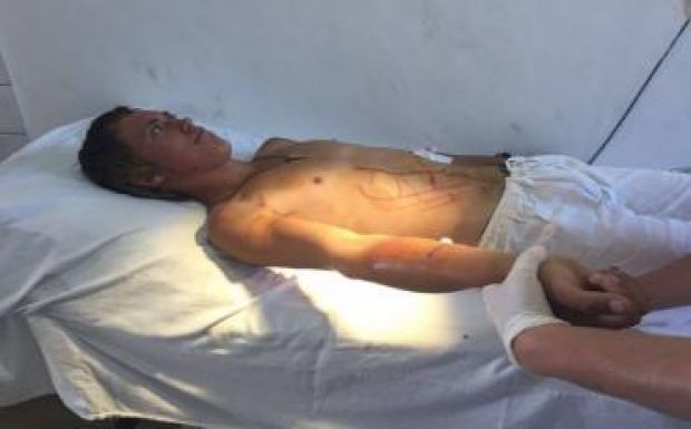 Újabb medvetámadás Székelyföldön: a pásztornak sikerült elmenekülnie