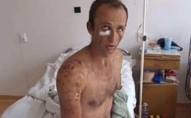 Két órán át műtötték a medvetámadásban megsérült csíkszentléleki férfit