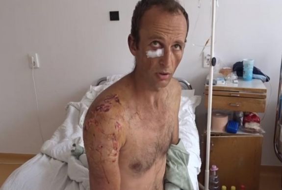 Gyűjtenek a medvetámadások áldozatainak megsegítésére Hargita megyében