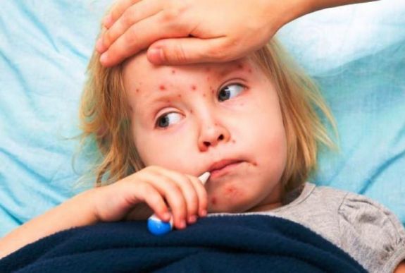 Terjed a kanyaró Kárpátalján, elfogyott az oltóanyag