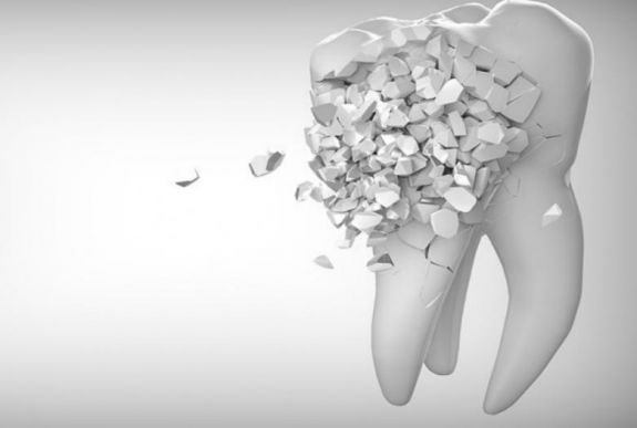 „Megelőzni sokkal könnyebb…” - dr. Kiss-Lőrincz Géza fogorvossal beszélgettünk