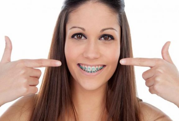 „A fogszabályozás kicsit olyan, mint a fogyókúra” – dr. Kiss-Lőrincz Géza fogorvos tanácsai