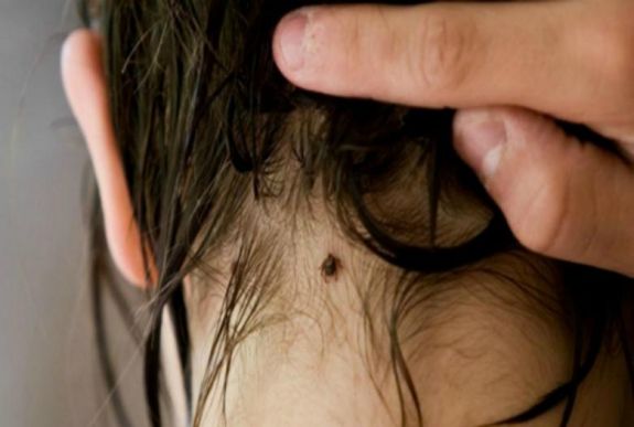 Kullancsszövetség: a kullancsok fele fertőz