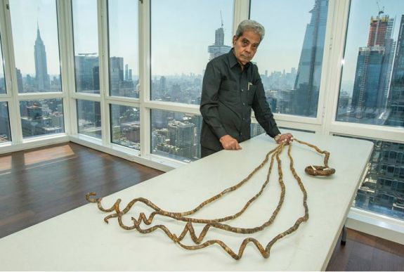 Megvált 66 éven át növesztett körmeitől egy indiai férfi