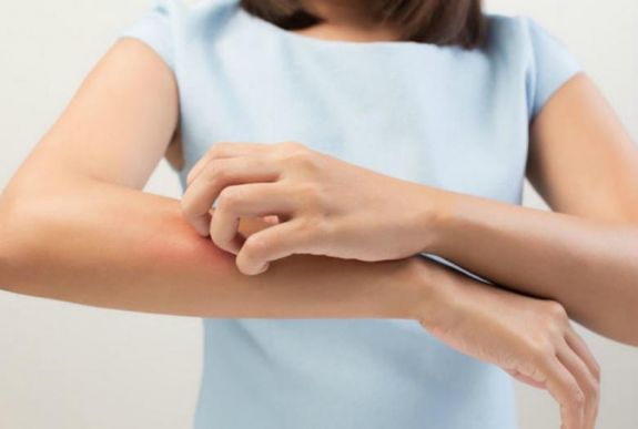 Néhány gondolat az atópiás dermatitiszről