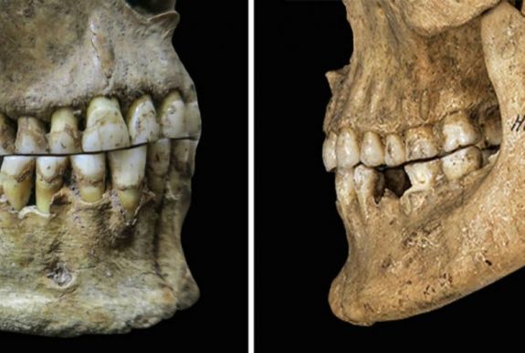 Nagy hatással volt őseink táplálkozása a mai emberi beszédre