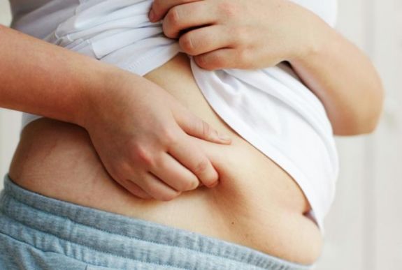 A véltnél legalább kétszer jobban növeli a rák kockázatát az elhízás