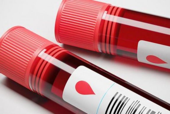 Új vérvizsgálat mutatja ki, megérjük-e a következő tíz évet