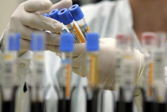 Fellélegezhetünk: nem koronavírusos beteg a bákói fiatalember