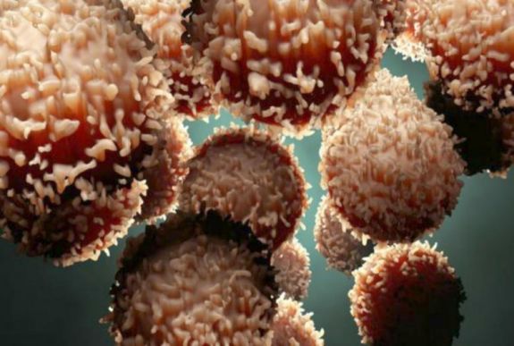 Korszakalkotó tanulmány változtathatja meg a rákbetegségek kezelését