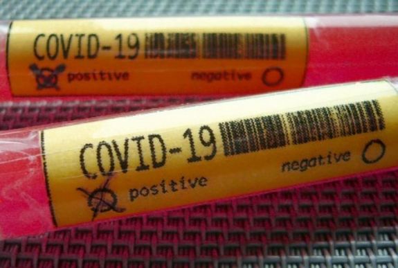 Kilencre nőtt Magyarországon a koronavírus-fertőzöttek száma