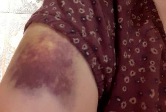 Bántalmazássá fajuló munkahelyi konfliktus a Marosvásárhelyi Rádióban?