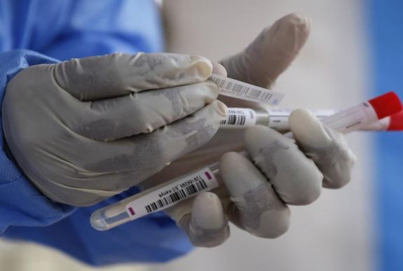 Moszkvában tömeges antitestszűrés kezdődött