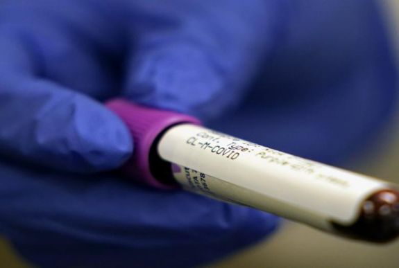 Ismét rekordszámú koronavírus-fertőzöttet regisztráltak egy nap alatt Magyarországon