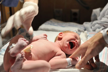 Index - Tudomány - Egy ritka születési rendellenesség miatt két pénisszel született egy brazil fiú
