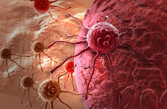 A rákot egyszerűen biológiai balszerencse okozza